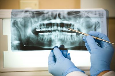 An Endodontist Can Conduct Diagnostic Tests and Can Interpret Dental Imaging!