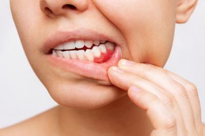 Determine Underlying Dental Problems!